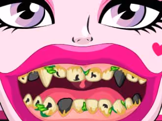 Draculaura Bad Teeth