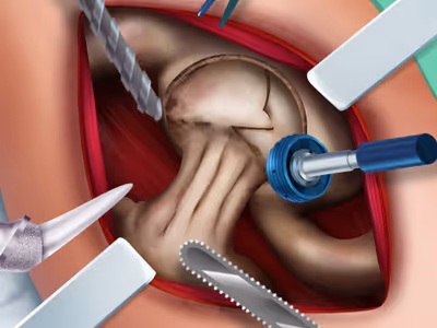 Ella Hip Surgery